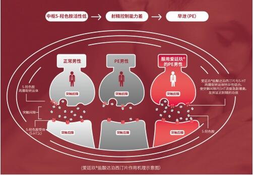 首个国产早泄药爱廷玖发布售价，赋能男性健康市场