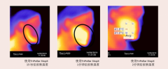 亚洲人皮肤三大特性：初普TriPollar射频美容仪提供针